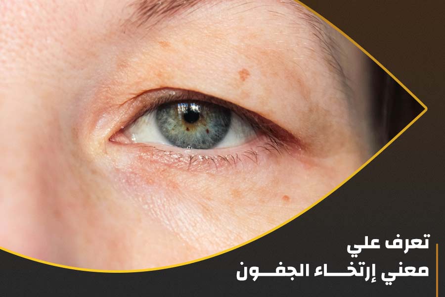 تعرف علي معني إرتخــــاء الجفـــون